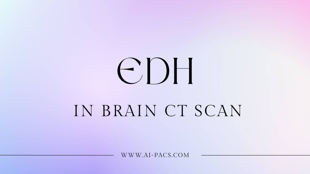 Medical Guide for Epidural Hematoma (EDH) on Brain CT Scan Diagnosis