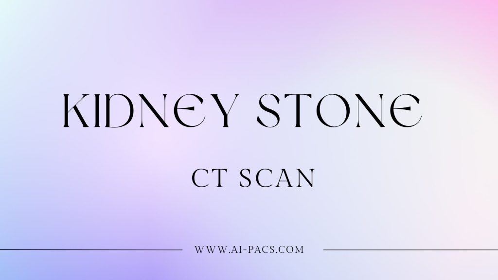 Kidney Stone CT Scan: Accurate Diagnosis and Procedure Overview