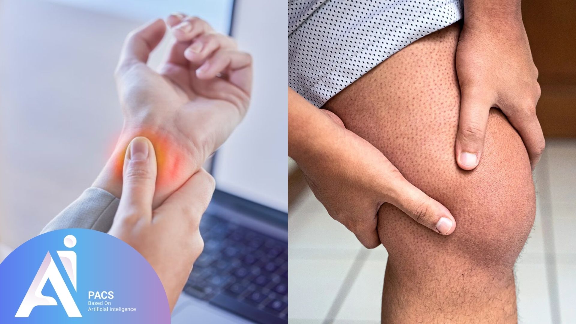 Image showing wrist and knee pain highlighting inflammation caused by bone marrow edema