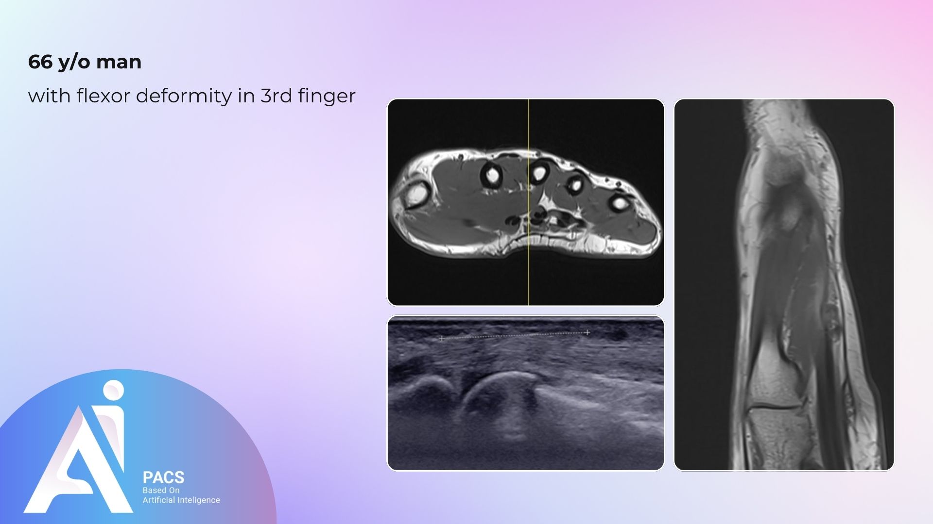 Radiology Cases: Understanding Diagnostic Imaging