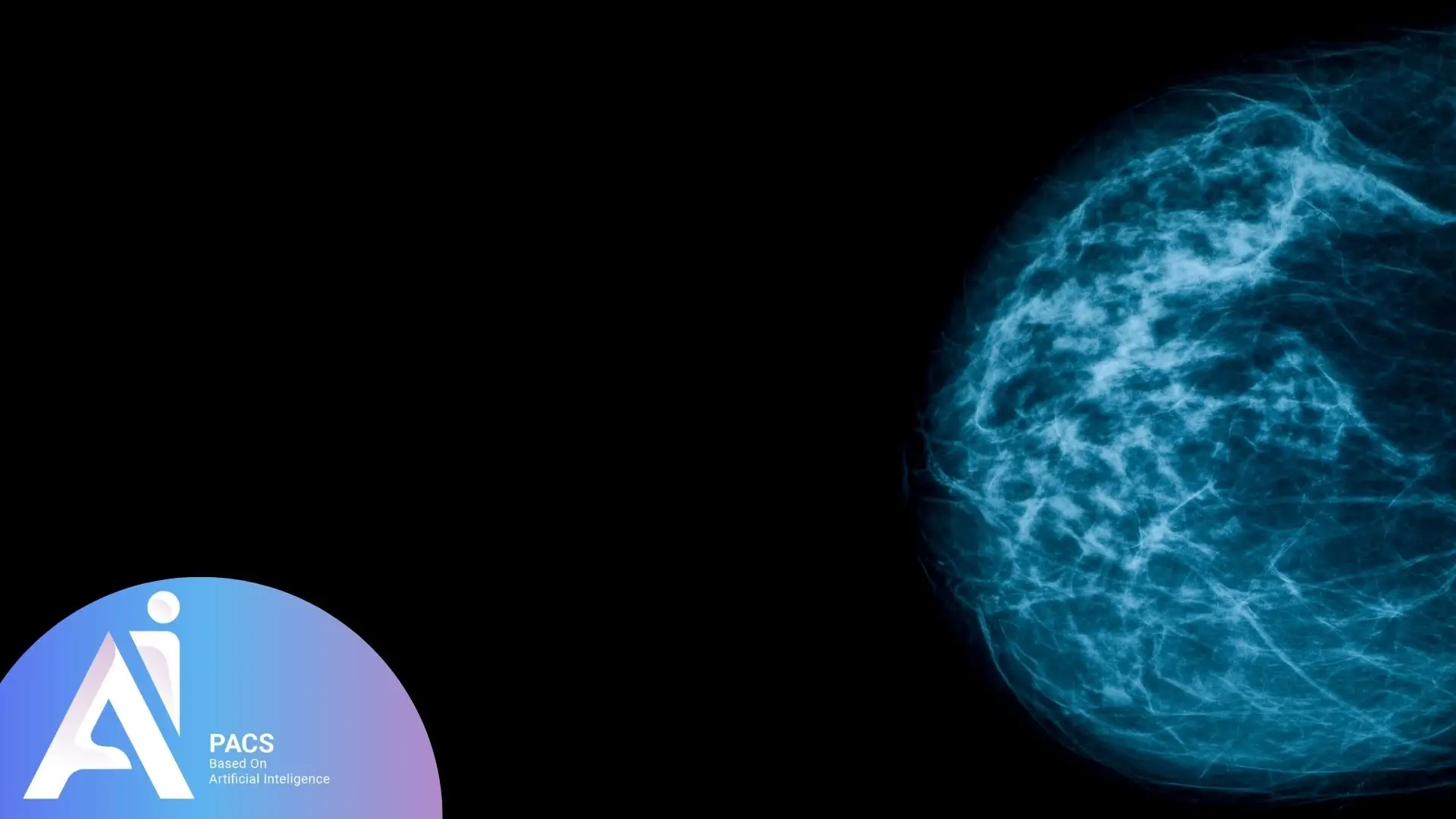asymmetry in the breast mammography 