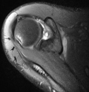 a close-up of a mri scan of a human ear