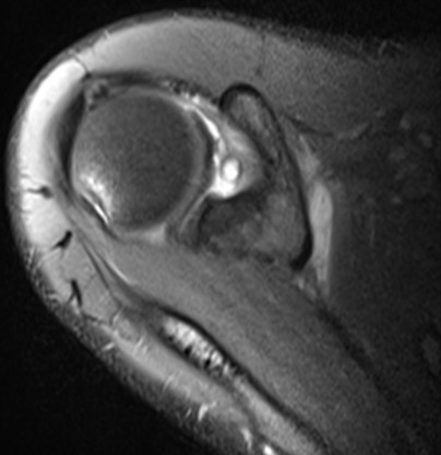 a close-up of a mri scan of a human ear