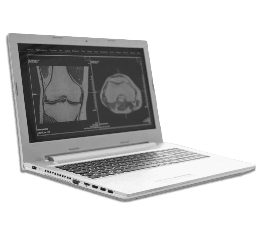 a laptop with x-ray image