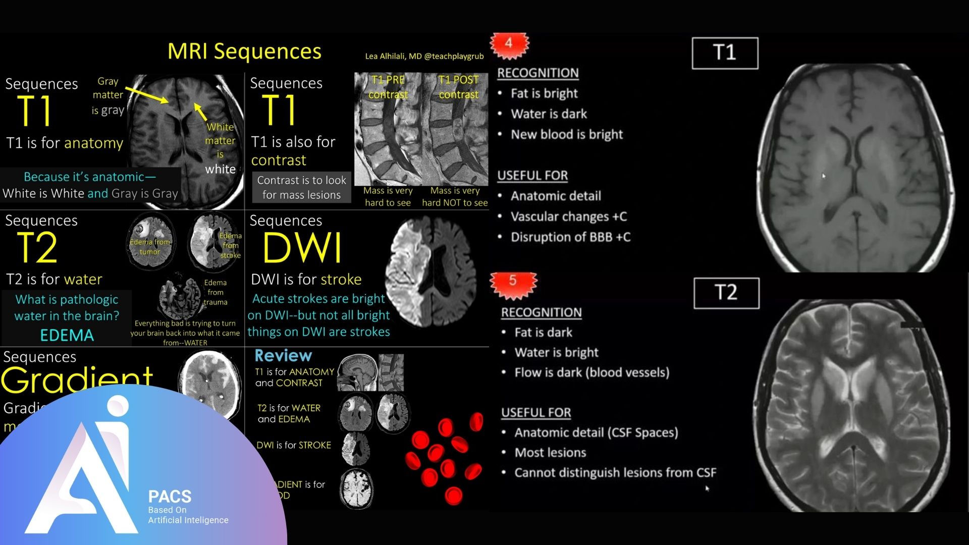 various MRI sequences (T1, T2, DWI, and Gradient) with explanations for each, highlighting their usefulness in identifying specific conditions like stroke, tumors, and anatomical details.