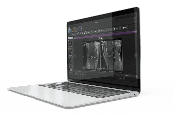 a laptop with a screen showing x-rays