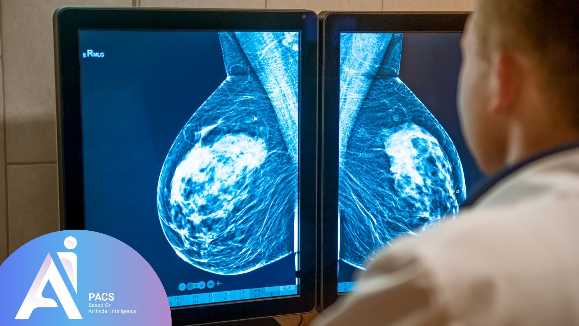 Reading and Interpreting Mammography