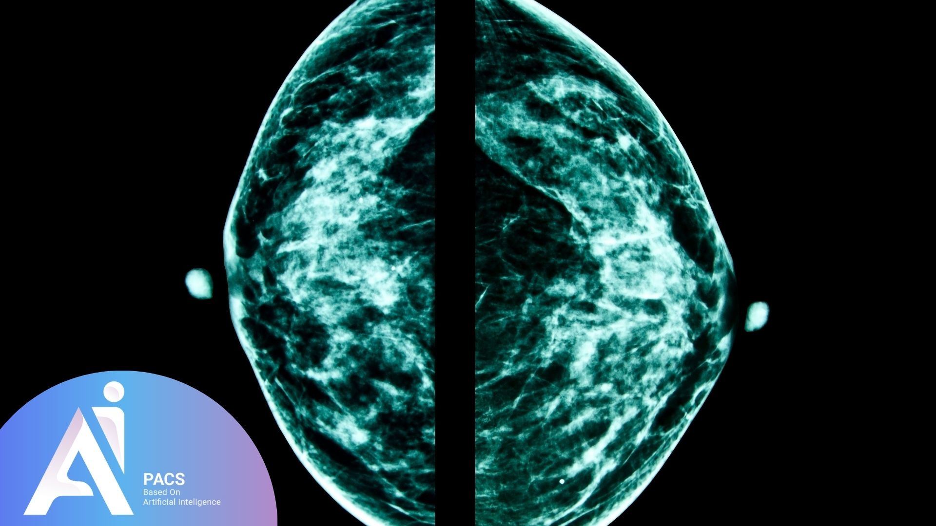 What Does BIRADS 0-6 Mean in Mammography?