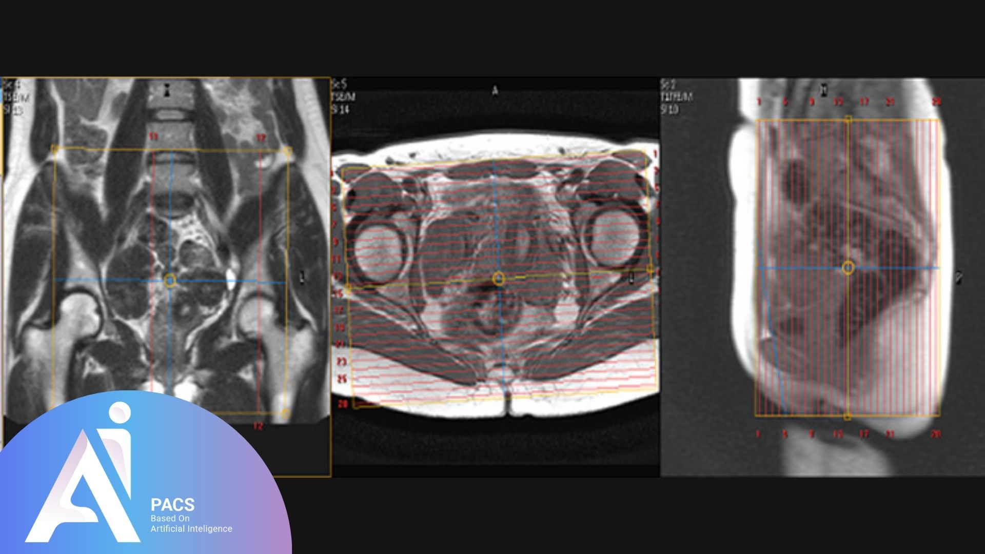 MR Defecation Imaging Test screen