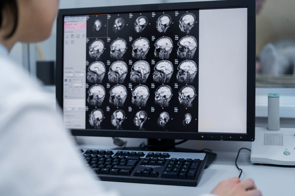 Radiologist checking MRI images during scanning process, highlighting need for detailed analysis and second opinion