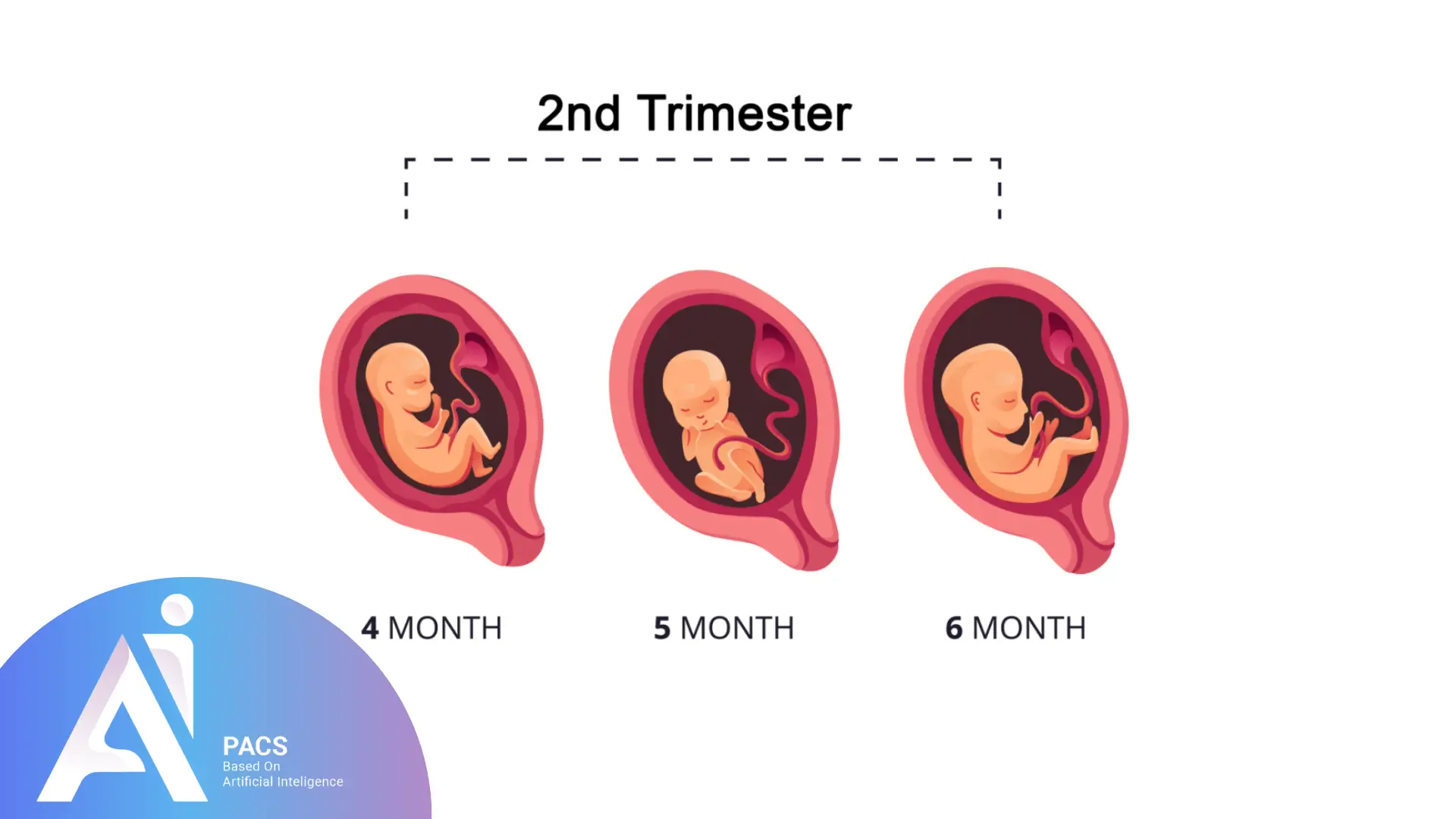 Pregnancy Ultrasound in Second Trimester Scans