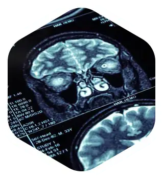 brain ct