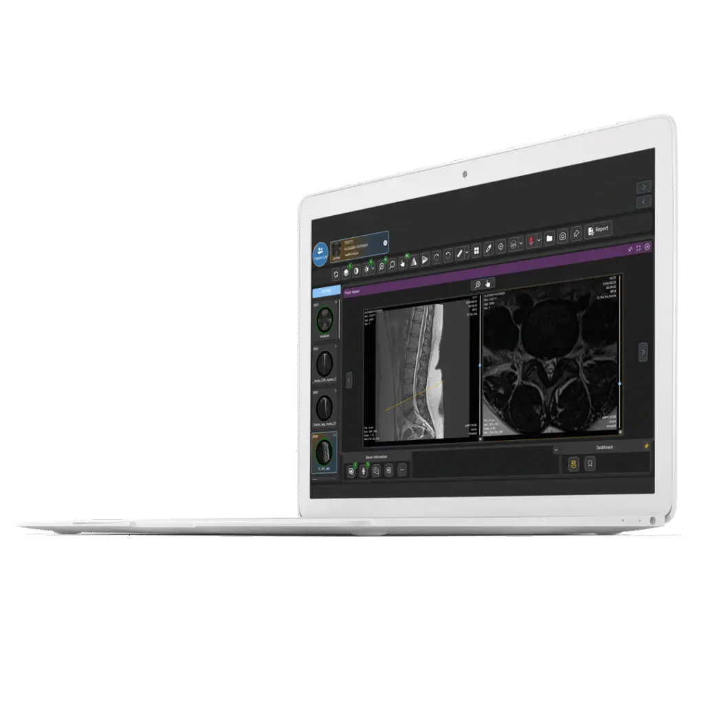 Ai-PACS