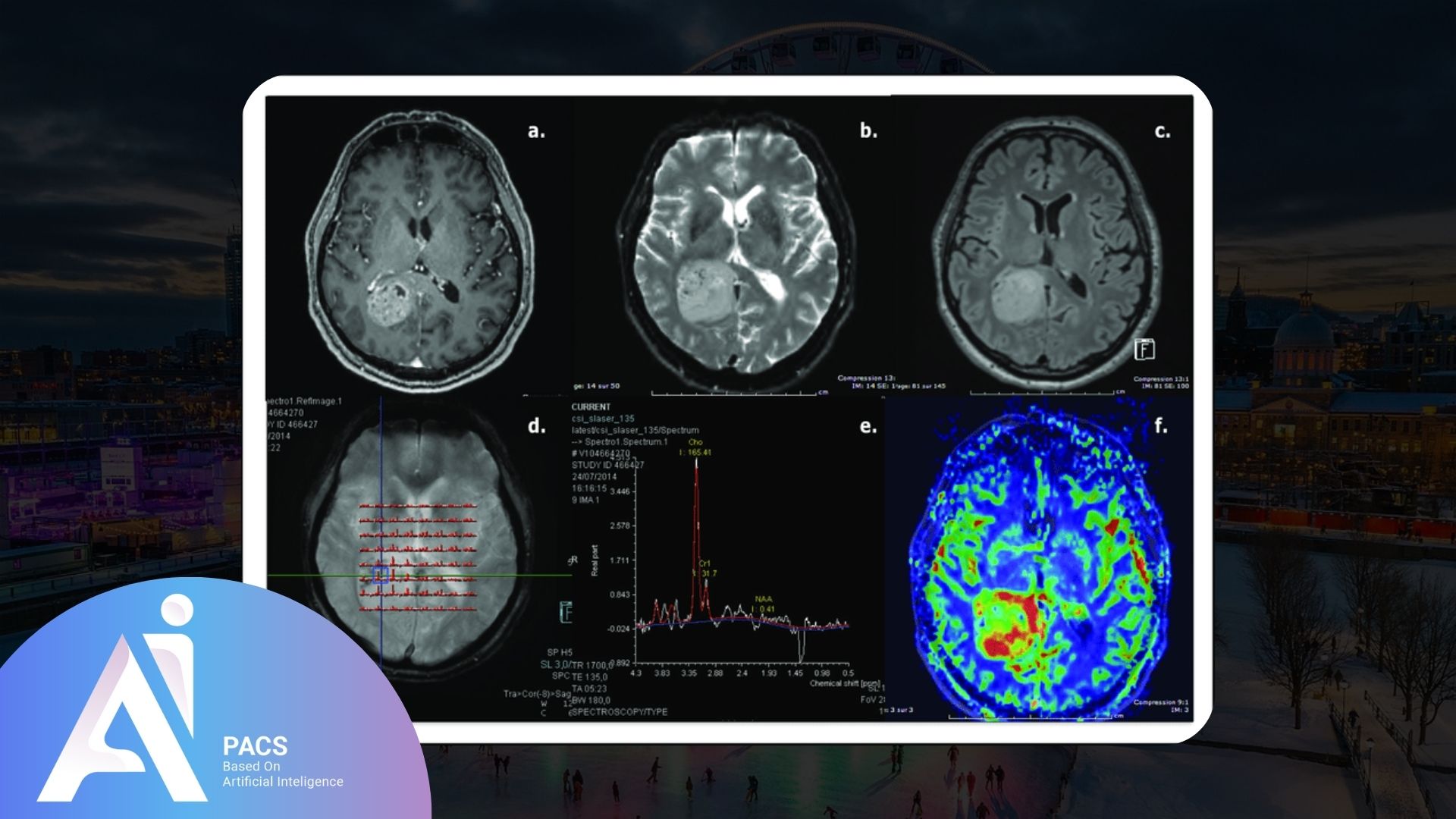 IRM cérébrale montrant des coupes du cerveau avec des annotations spécifiques. L'image inclut des spectres de résonance magnétique, des mesures chimiques et une image de la spectroscopie cérébrale.