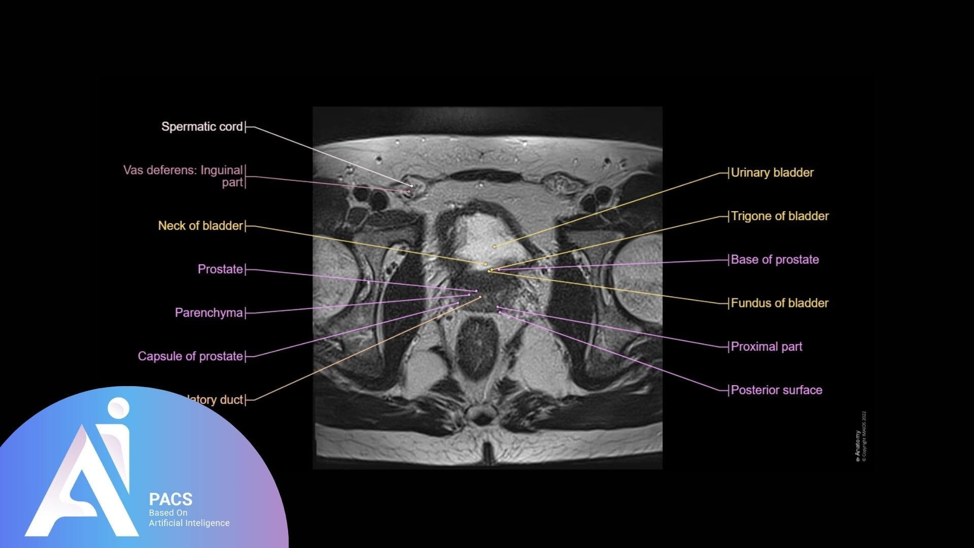 Male pelvic MRI axial view