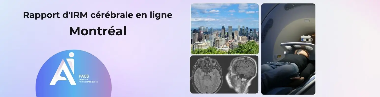 Rapport d'IRM cérébrale en ligne AI-PACS