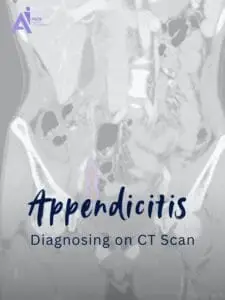 How CT Scans Aid in Diagnosing Appendicitis