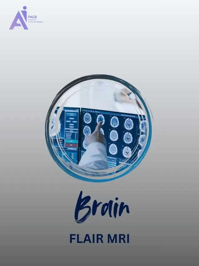 How FLAIR MRI Reveals Hidden Brain Changes