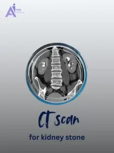 How CT Scans Detect Kidney Stones