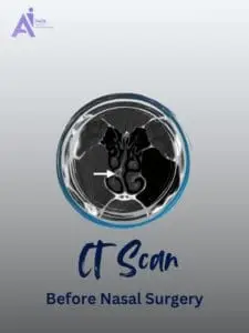 The Role of CT Scans in Planning Nasal Surgery