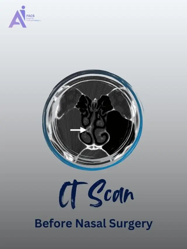 The Role of CT Scans in Planning Nasal Surgery