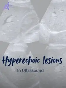 Bright Spots in Ultrasound