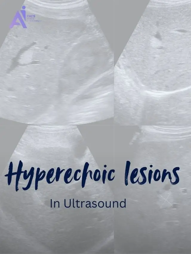 Bright Spots in Ultrasound