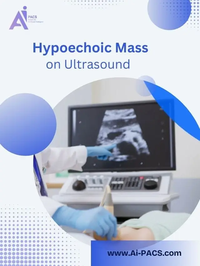 Exploring Hypoechoic Masses on Ultrasound