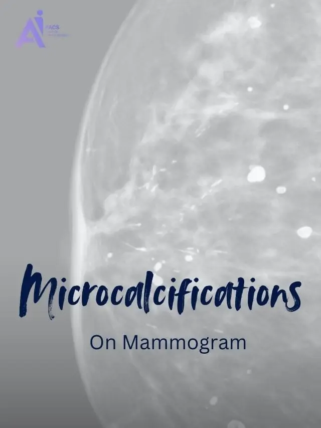 Get Expert Review for Your Mammogram Report and Ease Your Worries