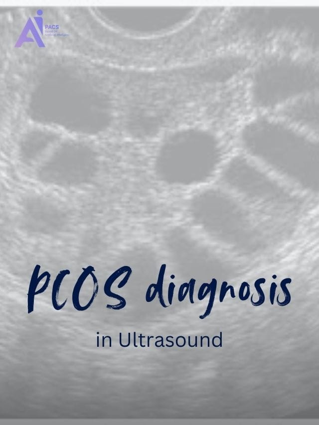 Ultrasound Features in PCOS Diagnosis