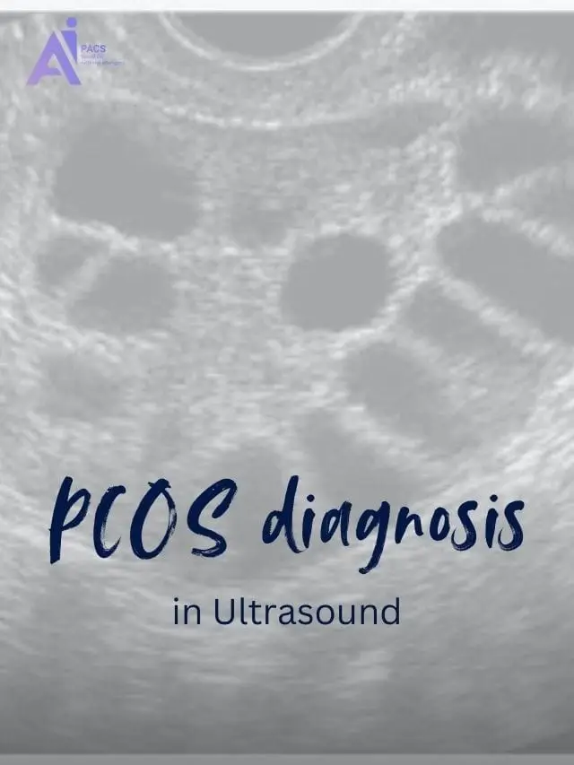 Ultrasound Features in PCOS Diagnosis