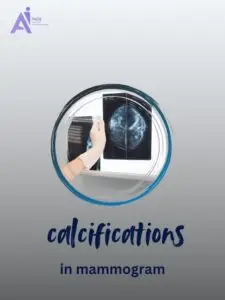 How Breast Calcifications Appear on Mammogram
