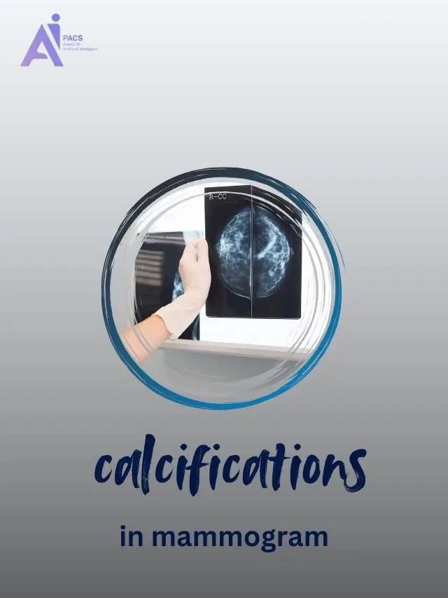 How Breast Calcifications Appear on Mammogram