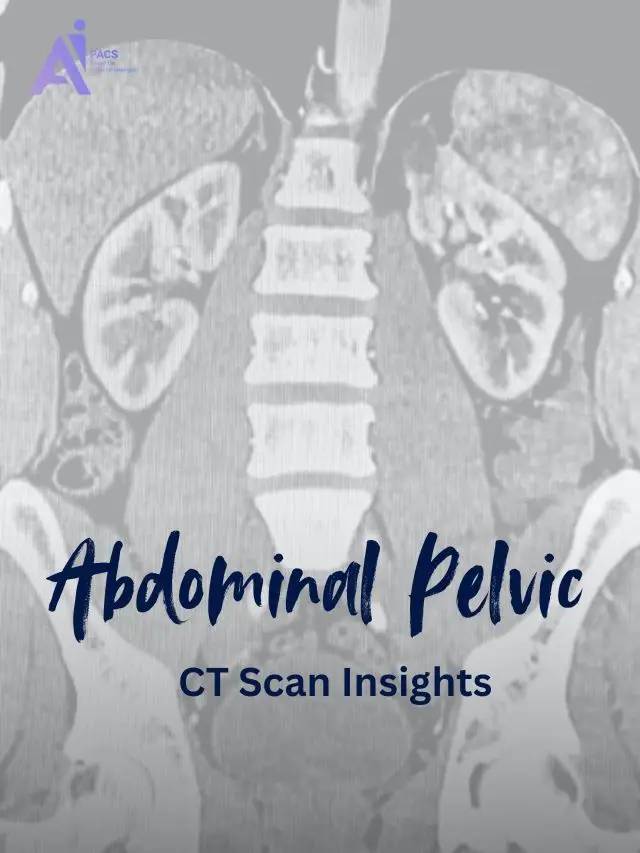 What Your Abdominal and Pelvic CT Scan Reveals