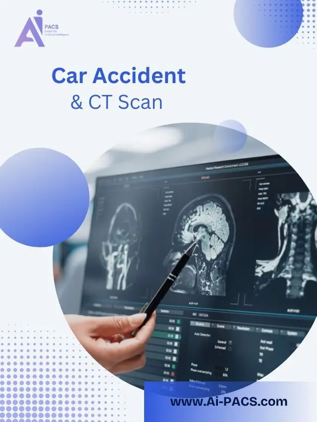 Why CT Scans Are Crucial After Car Accidents