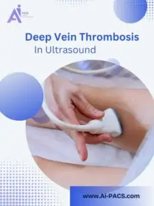 The Role of Ultrasound in Identifying DVT Early
