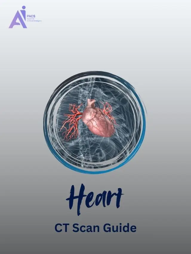 A Simple Guide to Understanding Your Heart CT Scan