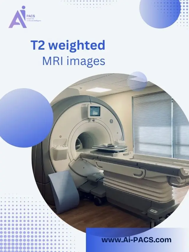 Decoding T2-Weighted MRI Images