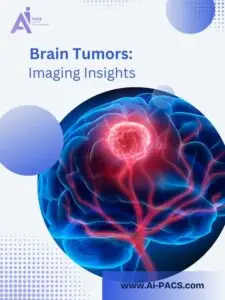 Brain Tumors: What Imaging Shows