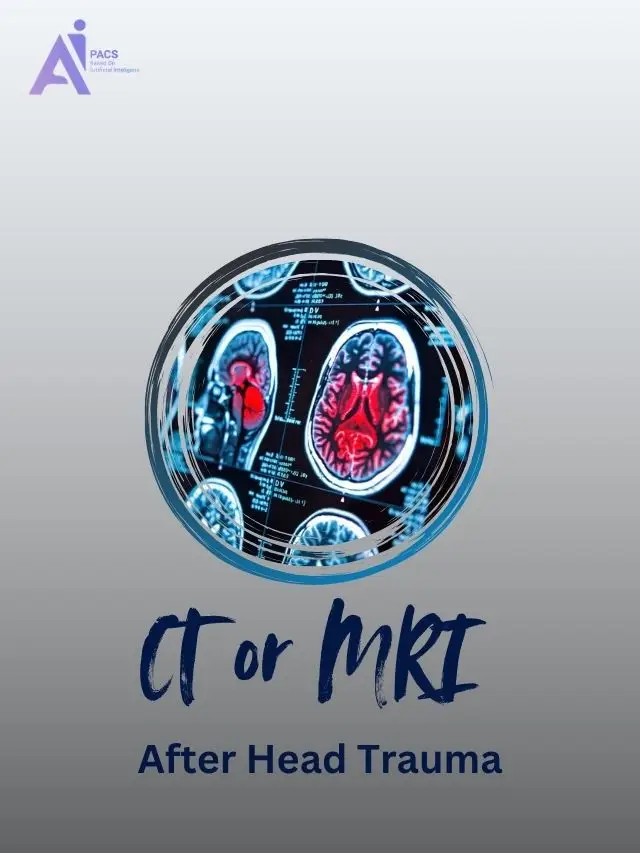 How Brain Imaging Helps After Head Injury