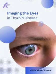 MRI Insights for Thyroid Eye Disease