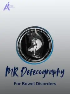 How MR Defecography Helps Diagnose Bowel Issues