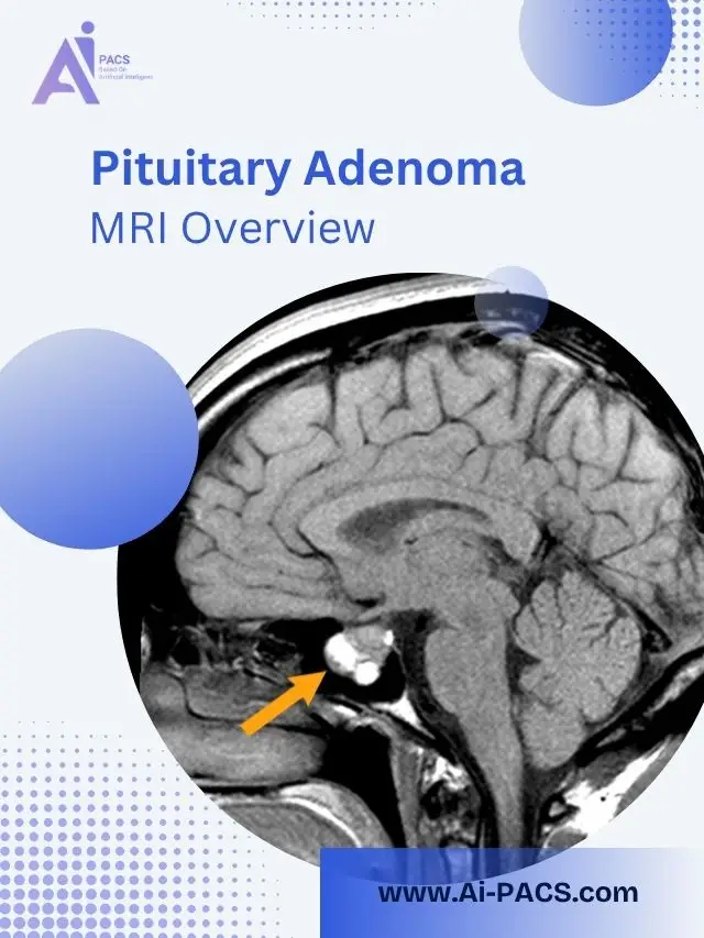 MRI Insights for Pituitary Disorders