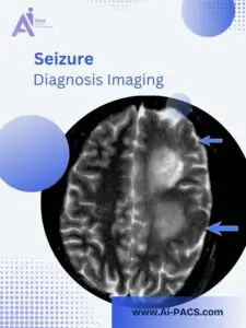 Detecting Seizures Effectively