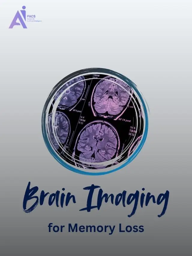 Brain Imaging and Memory Loss: What You Should Know