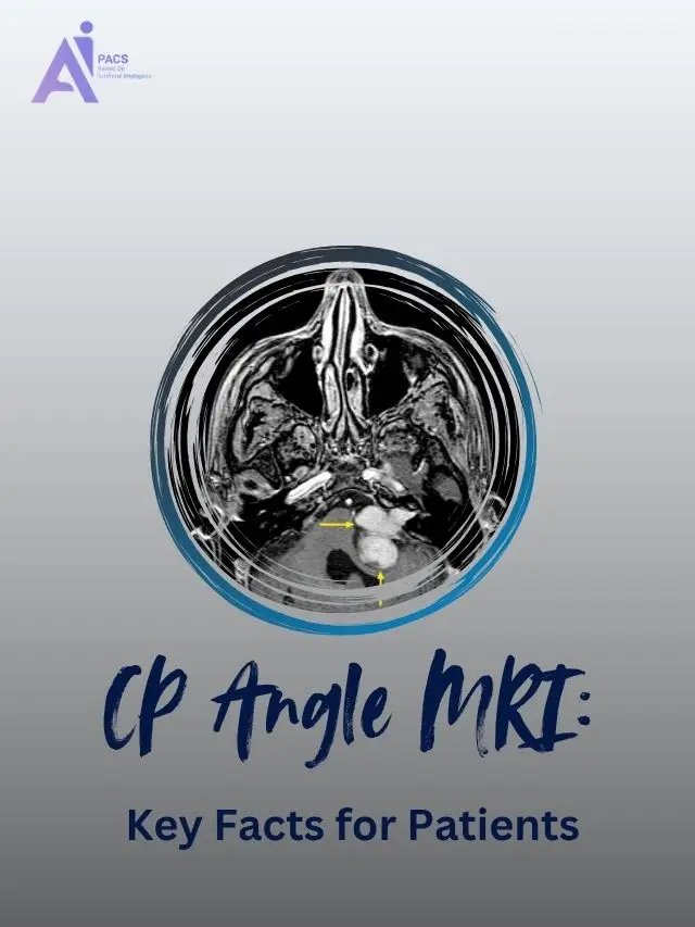 Cerebellopontine (CP) Angle MRI Basics