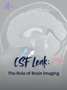 How Brain Imaging Helps Detect CSF Leaks