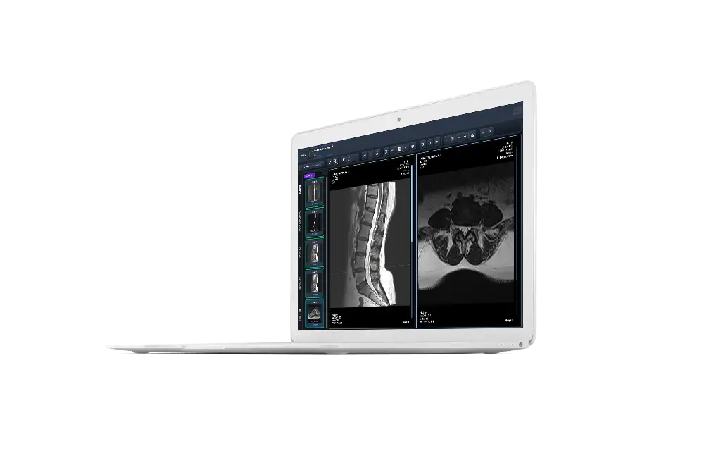 Next Gen Pacs Software With AI Integration