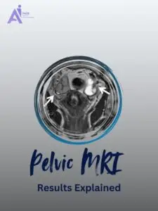 Pelvic MRI Results Made Simple: What You Should Know