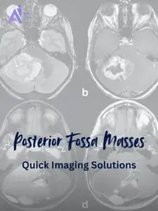Detecting Posterior Fossa Masses: Why MRI Matters